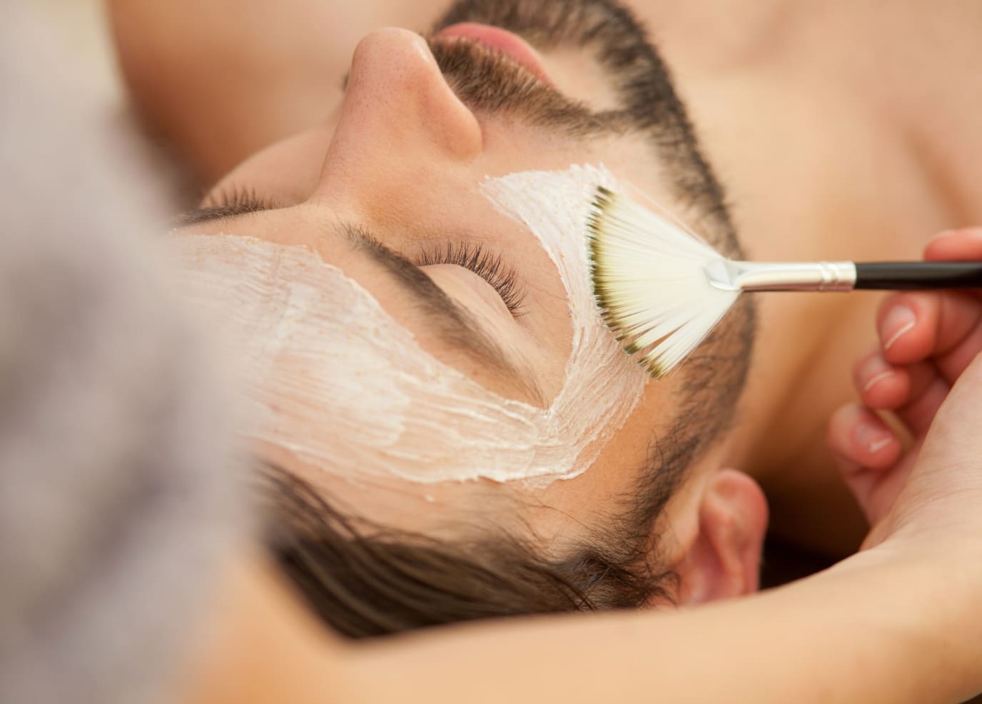 Peeling visage à Montpellier | Peeling chimique visage | Médecine esthétique | Clinique beauté