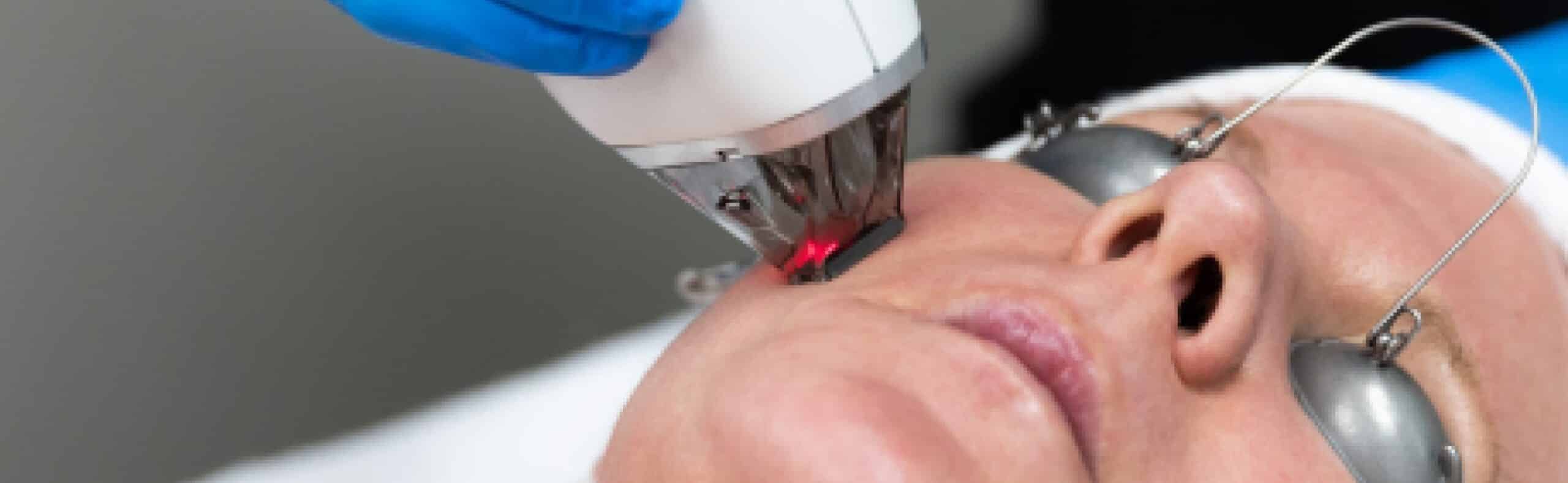 Moxi Laser by sciton