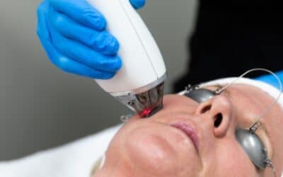 Moxi Laser by sciton