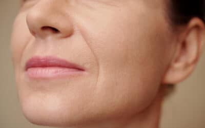 BBL SkinSmooth™ par Sciton | HIND Clinique de Beauté | Montpellier