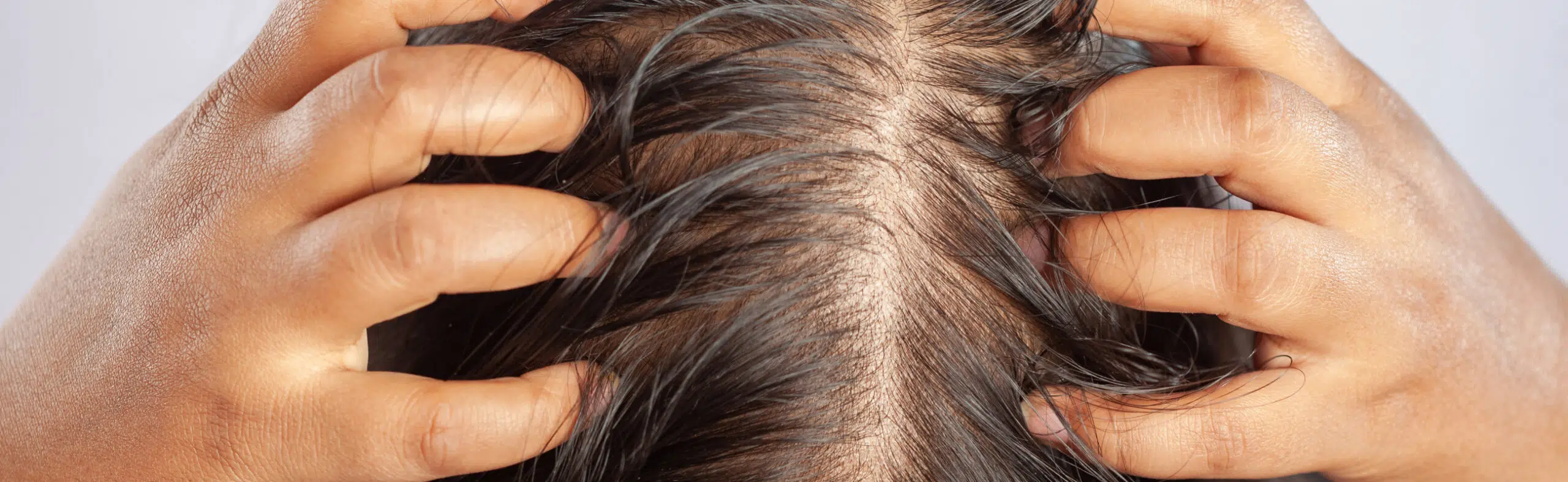 Pourquoi je perds mes cheveux à l’approche de la ménopause ? | HIND Clinique de Beauté | Montpellier